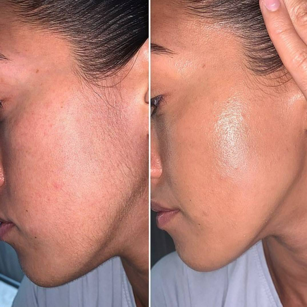 Dr. Meinaier Colagénio e Retinol